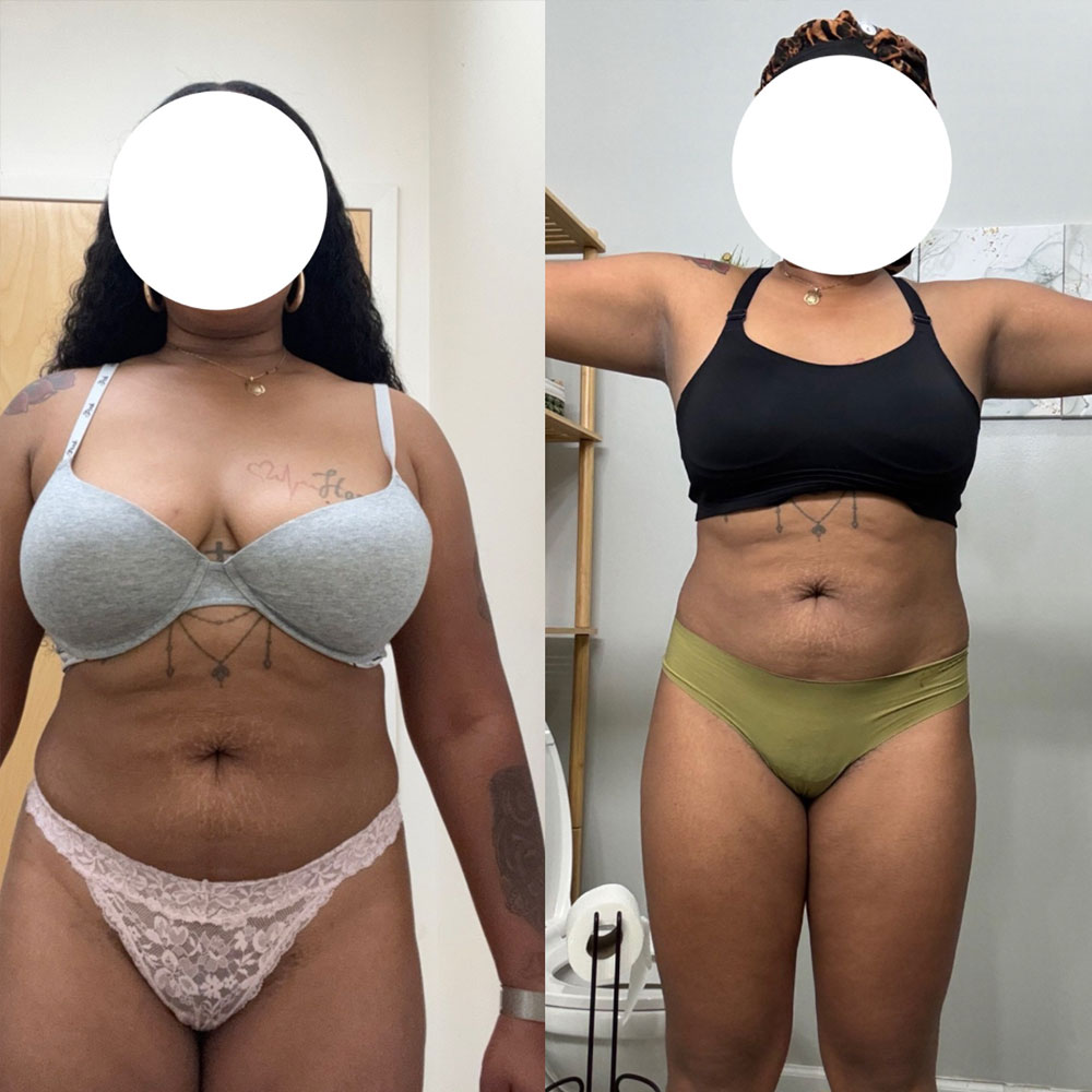 Transformation 1