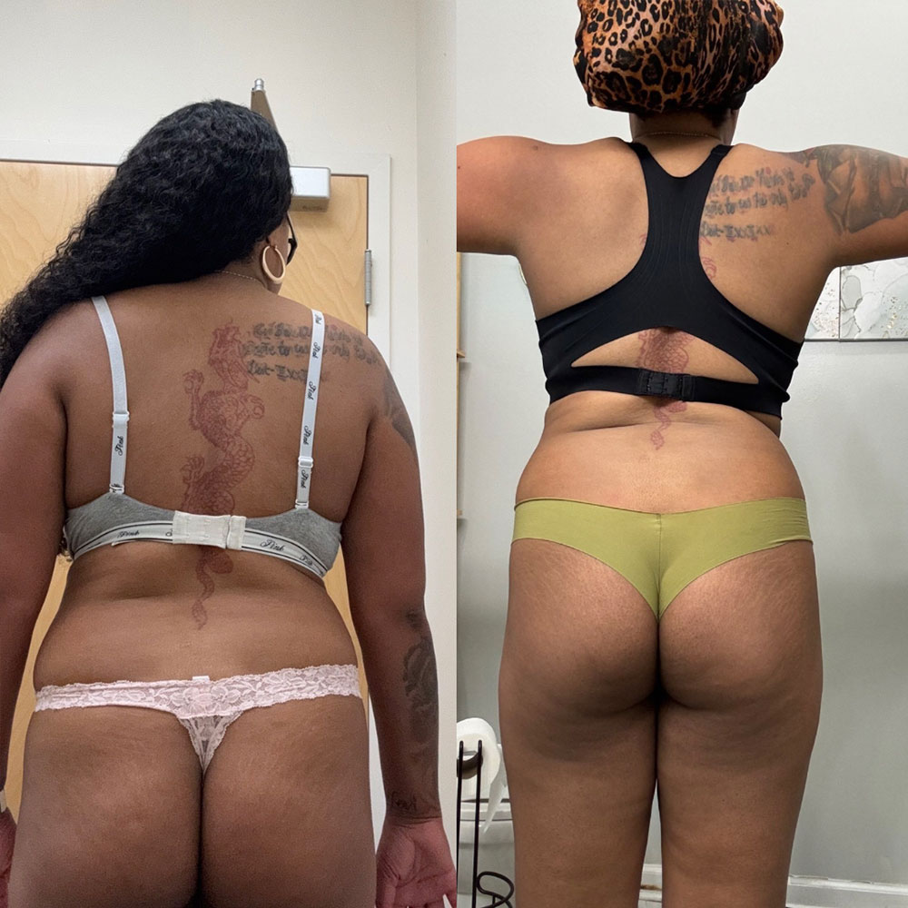 Transformation 2